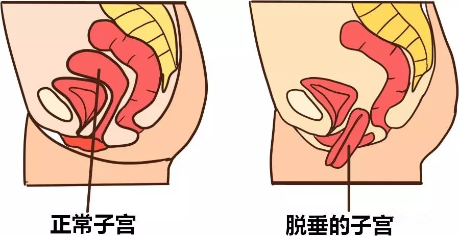 2.支持盆腔器官.webp.jpg